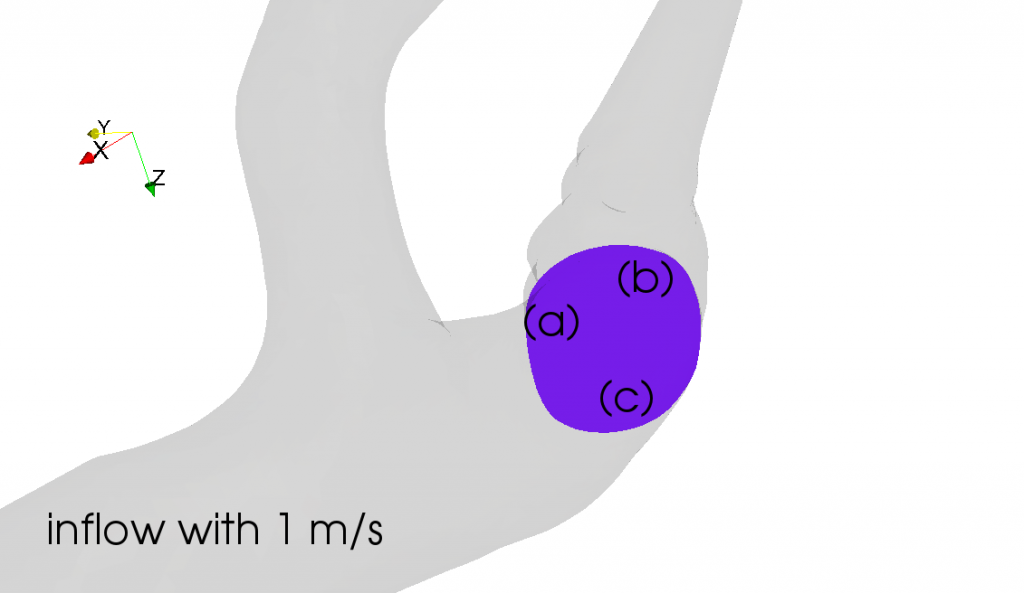 At which place the blood flow reaches the highest velocity? Is it (a), (b), or (c)?