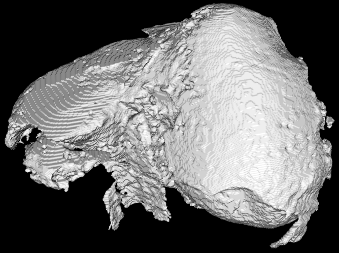 Medical image segmentation and visualization