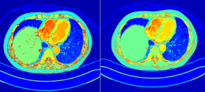 Segmentation results